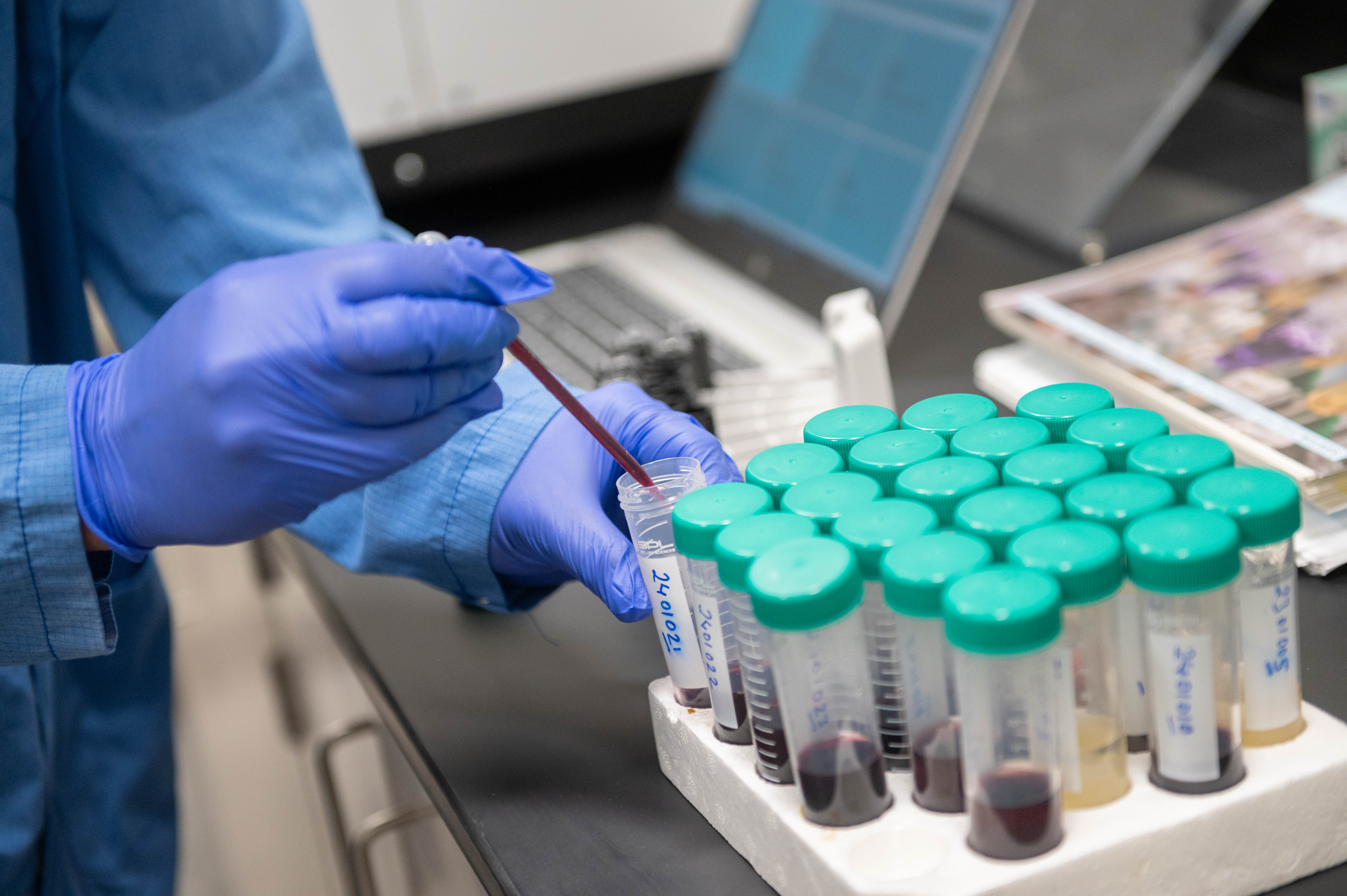 Wine sample being extracted from test tube